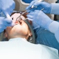 Emergency Protocols in Case of Complications: Ensuring Safety in Sedation Dentistry
