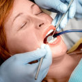Exploring the Possible Side Effects and Complications of Sedation Dentistry
